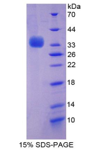 BECN1 / Beclin-1 Protein - Recombinant Beclin 1 By SDS-PAGE