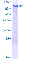 BEGAIN Protein - 12.5% SDS-PAGE of human BEGAIN stained with Coomassie Blue