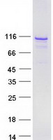 BEND3 Protein - Purified recombinant protein BEND3 was analyzed by SDS-PAGE gel and Coomassie Blue Staining