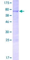 BEND4 Protein - 12.5% SDS-PAGE of human CCDC4 stained with Coomassie Blue