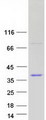 BEND5 Protein - Purified recombinant protein BEND5 was analyzed by SDS-PAGE gel and Coomassie Blue Staining