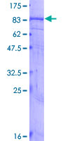BEST1 / BEST / Bestrophin Protein - 12.5% SDS-PAGE of human BEST1 stained with Coomassie Blue