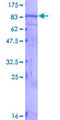 BEST1 / BEST / Bestrophin Protein - 12.5% SDS-PAGE of human BEST1 stained with Coomassie Blue