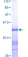 BEST1 / BEST / Bestrophin Protein - 12.5% SDS-PAGE Stained with Coomassie Blue.