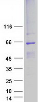 BEST1 / BEST / Bestrophin Protein - Purified recombinant protein BEST1 was analyzed by SDS-PAGE gel and Coomassie Blue Staining