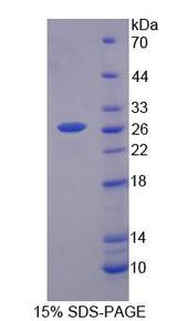 BEST2 / Bestrophin-2 Protein - Recombinant Bestrophin 2 (BEST2) by SDS-PAGE