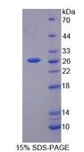 BEST2 / Bestrophin-2 Protein - Recombinant Bestrophin 2 (BEST2) by SDS-PAGE