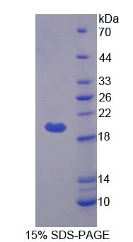 BEST4 Protein - Recombinant Bestrophin 4 (BEST4) by SDS-PAGE
