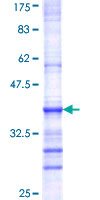 BET1 Protein - 12.5% SDS-PAGE Stained with Coomassie Blue