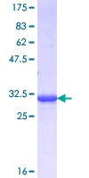 BF1 / FOXG1 Protein - 12.5% SDS-PAGE Stained with Coomassie Blue.