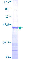 BFSP1 / Filensin Protein - 12.5% SDS-PAGE Stained with Coomassie Blue.