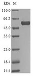BGN / Biglycan Protein - (Tris-Glycine gel) Discontinuous SDS-PAGE (reduced) with 5% enrichment gel and 15% separation gel.