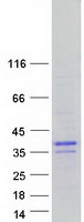 BHLHA9 Protein - Purified recombinant protein BHLHA9 was analyzed by SDS-PAGE gel and Coomassie Blue Staining
