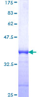 BHLHB2 / DEC1 Protein - 12.5% SDS-PAGE Stained with Coomassie Blue.