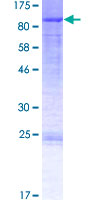 BHLHB9 Protein - 12.5% SDS-PAGE of human BHLHB9 stained with Coomassie Blue