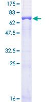 BHMT Protein - 12.5% SDS-PAGE of human BHMT stained with Coomassie Blue