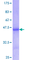 BHMT Protein - 12.5% SDS-PAGE Stained with Coomassie Blue.