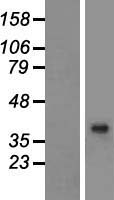 BHMT2 Protein - Western validation with an anti-DDK antibody * L: Control HEK293 lysate R: Over-expression lysate