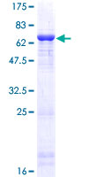 BHMT2 Protein - 12.5% SDS-PAGE of human BHMT2 stained with Coomassie Blue