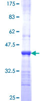 BHMT2 Protein - 12.5% SDS-PAGE Stained with Coomassie Blue.