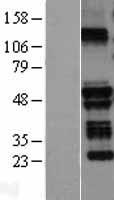 BIA2 / TRIM58 Protein - Western validation with an anti-DDK antibody * L: Control HEK293 lysate R: Over-expression lysate