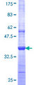 BIA2 / TRIM58 Protein - 12.5% SDS-PAGE Stained with Coomassie Blue.