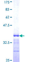 BICD1 Protein - 12.5% SDS-PAGE Stained with Coomassie Blue.