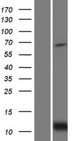 BID Protein - Western validation with an anti-DDK antibody * L: Control HEK293 lysate R: Over-expression lysate