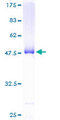 BID Protein - 12.5% SDS-PAGE of human BID stained with Coomassie Blue