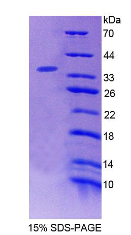 BIN2 Protein - Recombinant  Bridging Integrator 2 By SDS-PAGE