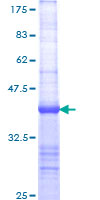 BIRC1 / NAIP Protein - 12.5% SDS-PAGE Stained with Coomassie Blue.