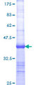 BIRC1 / NAIP Protein - 12.5% SDS-PAGE Stained with Coomassie Blue.