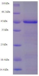 BIRC1 / NAIP Protein