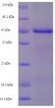 BIRC1 / NAIP Protein