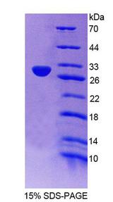 BIRC1 / NAIP Protein - Recombinant  Neuronal Apoptosis Inhibitory Protein By SDS-PAGE