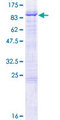 BIRC2 / cIAP1 Protein - 12.5% SDS-PAGE of human BIRC2 stained with Coomassie Blue
