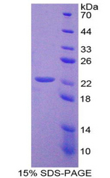 BIRC2 / cIAP1 Protein - Recombinant Baculoviral IAP Repeat Containing Protein 2 By SDS-PAGE