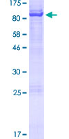 BIRC3 / cIAP2 Protein - 12.5% SDS-PAGE of human BIRC3 stained with Coomassie Blue