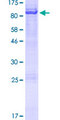 BIRC3 / cIAP2 Protein - 12.5% SDS-PAGE of human BIRC3 stained with Coomassie Blue