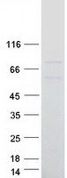 BIRC3 / cIAP2 Protein - Purified recombinant protein BIRC3 was analyzed by SDS-PAGE gel and Coomassie Blue Staining