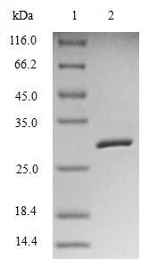 BIRC5 / Survivin Protein - (Tris-Glycine gel) Discontinuous SDS-PAGE (reduced) with 5% enrichment gel and 15% separation gel.