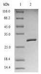 BIRC5 / Survivin Protein - (Tris-Glycine gel) Discontinuous SDS-PAGE (reduced) with 5% enrichment gel and 15% separation gel.