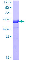 BIRC5 / Survivin Protein - 12.5% SDS-PAGE of human BIRC5 stained with Coomassie Blue