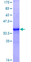 BIRC5 / Survivin Protein - 12.5% SDS-PAGE Stained with Coomassie Blue.