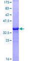BIRC5 / Survivin Protein - 12.5% SDS-PAGE Stained with Coomassie Blue.
