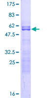BIRC7 / Livin Protein - 12.5% SDS-PAGE of human BIRC7 stained with Coomassie Blue
