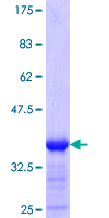 BIRC7 / Livin Protein - 12.5% SDS-PAGE Stained with Coomassie Blue.