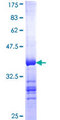 BIRC8 / ILP2 Protein - 12.5% SDS-PAGE Stained with Coomassie Blue.