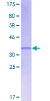 BLC / CXCL13 Protein - 12.5% SDS-PAGE of human CXCL13 stained with Coomassie Blue