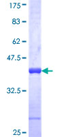 BLID Protein - 12.5% SDS-PAGE Stained with Coomassie Blue.